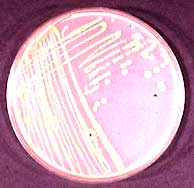 flavobacterium