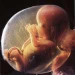 le foetus humain
